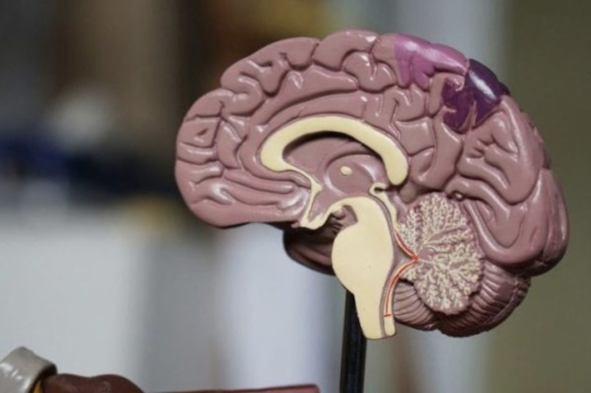 Cientistas brasileiros mapeiam 129 novos caminhos genéticos contra Alzheimer